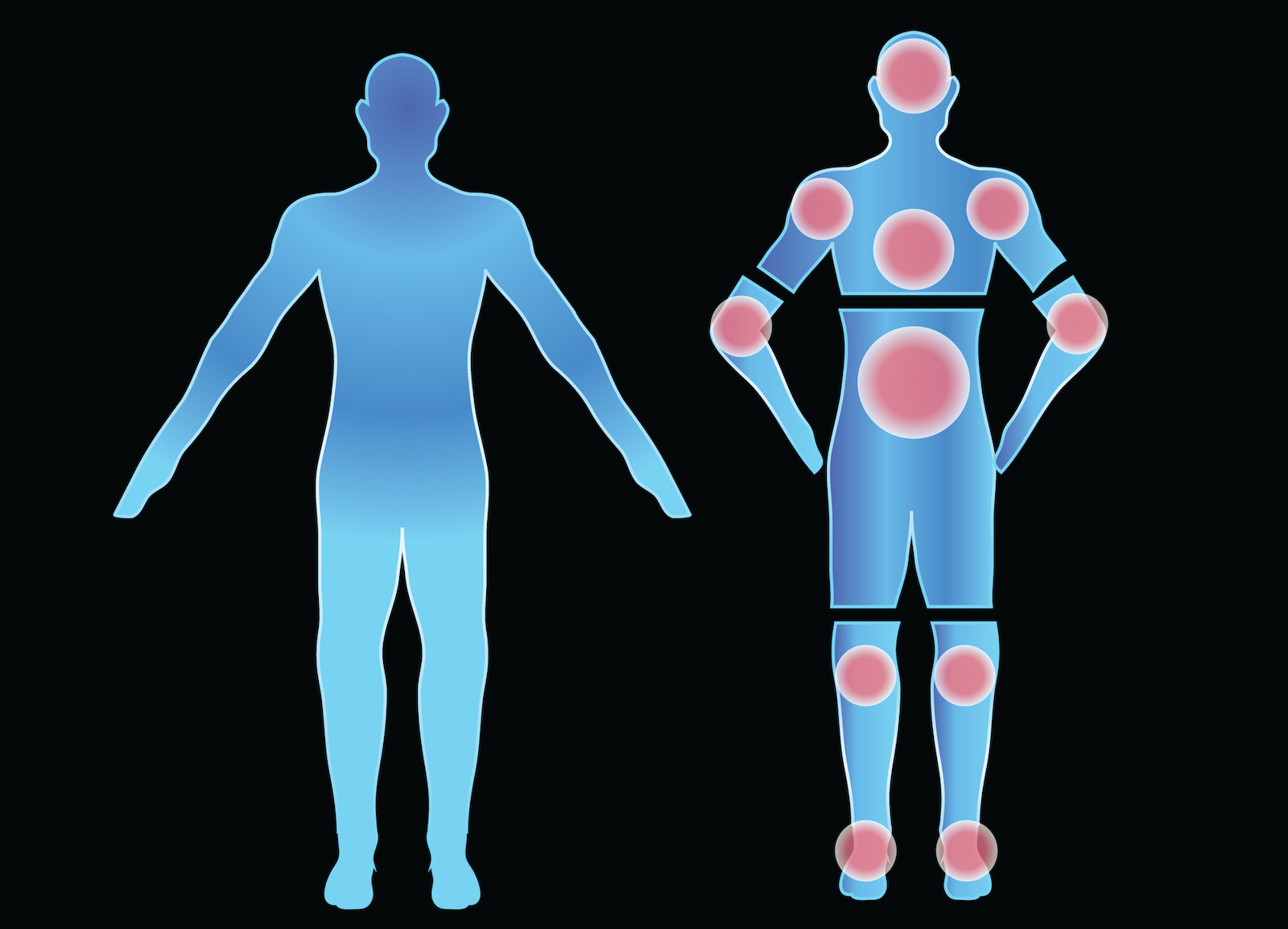 local osteopath improve pain sports injury chart